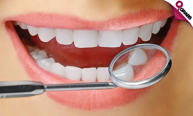 Zoom Teeth Whitening + Consultation!